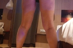 Hot
