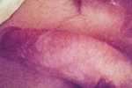 hungazfuk — dickkkk