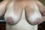 KindLotus38DD