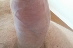 dick