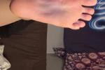 feet