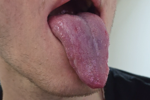 tongue