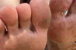 feet #3