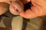cock head / glans (12 pics )