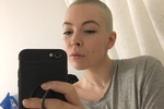 Shaved head