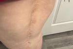 Scar