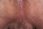 Anal plugs