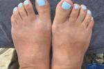 toes :)