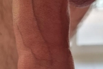 Dick