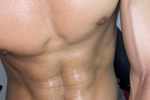 Veins