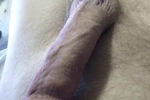 dick