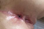 Lina’s gape 😋