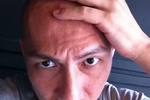 me1