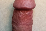 The Cock head