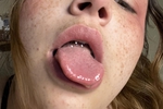 Spit