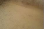 Nipples