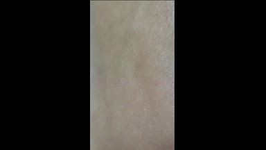 🦶🔥