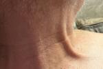 mrgrimmdragon โ See the Scar
