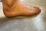 tinus — feet
