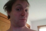 no hair