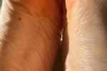 Macro feet