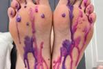 Little legs, hot candles