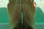 Feet, legs