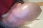 :P