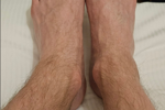 Feet bundle