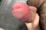 Chupa-chups