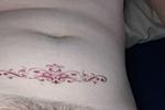 Tramp stamp