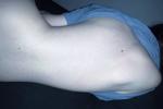 backs and tummies