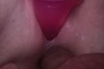 DP and anal
