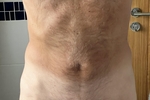 Front view flashing