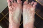 Oil on soles of feet