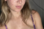 Glazed face