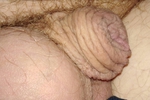 Tiny shrivelled cock