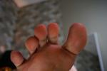 clean up my barefeet toes