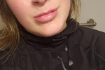 Facial