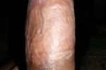 Dry Dick Set