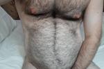 Hairy body