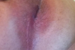 My tight hole
