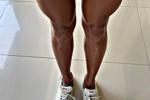 my legs