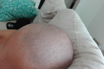 shaved head