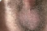 joefxmn live Chaturbate webcam gallery thumbnail