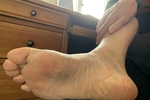 feet 2