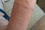 %%