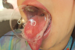 look at my saliva bubbles