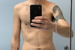 admri โ Body/Chest