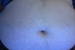 Belly